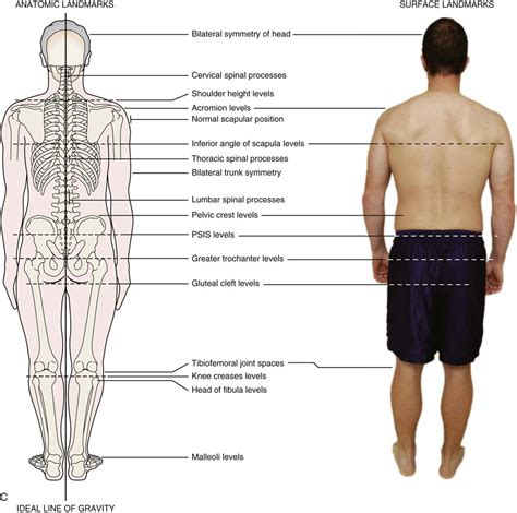 Assessment Of Posture Musculoskeletal Key