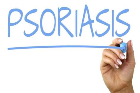 Everything You Need To Know About Psoriasis Biomedj