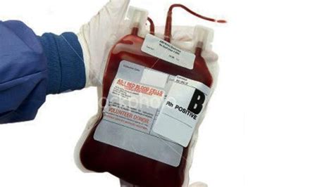 How Much Is A Pint Of Blood Public Health