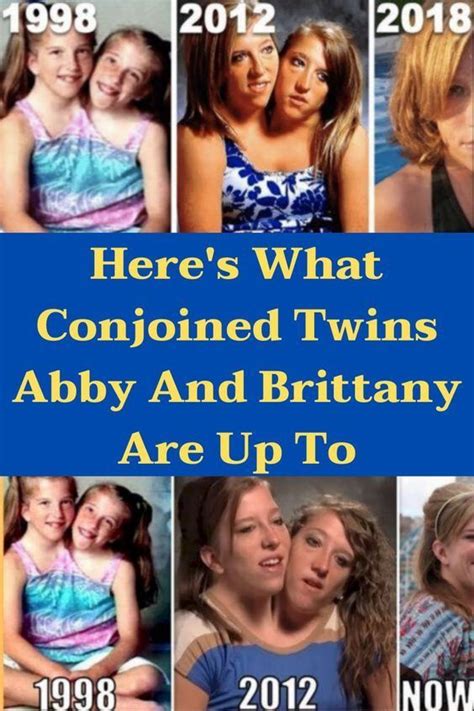 By Now You’ve Probably At Least Seen The Hensel Twins In The Media The Conjoined Twins Abby