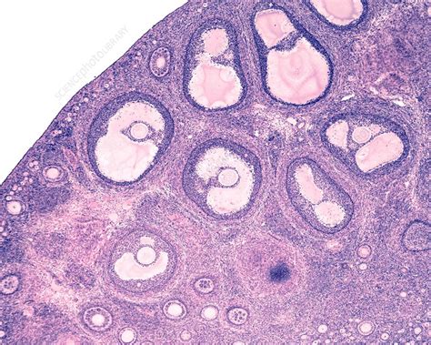 Ovarian Follicles Light Micrograph Stock Image C0456650 Science