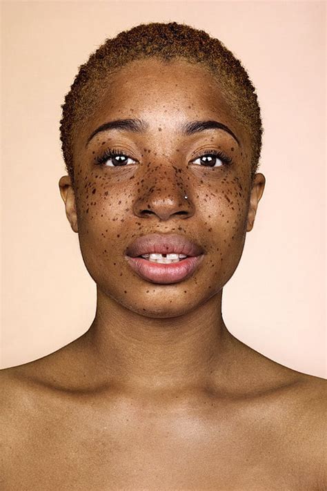 Why black lives matter still matters. Why Do We Have Freckles On Our Face? - Frolicious ...