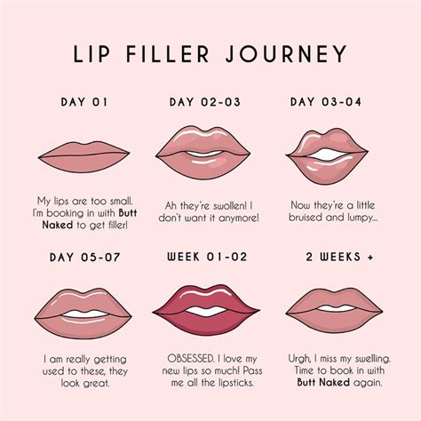 Lip Filler Journey Lip Fillers Facial Aesthetics Aesthetic Clinic