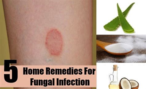 Eri And Ada Fungi In The Face Treatment And Secrets To Heal Your Skin