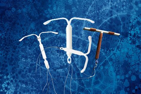 What Is An Iud And How Does It Work