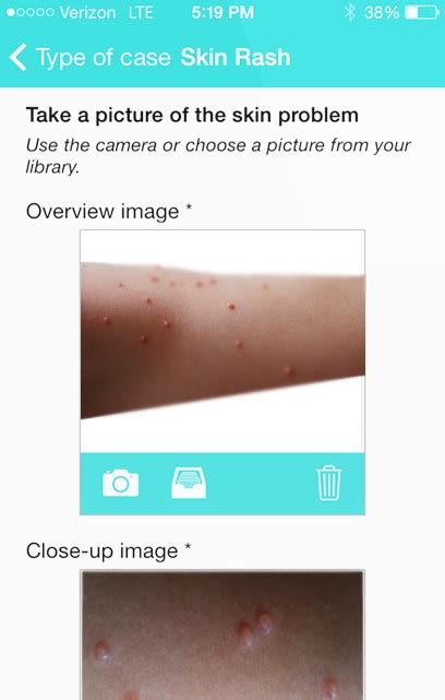 Idoc Launches Dermatology Q A App For Mothers Mobihealthnews