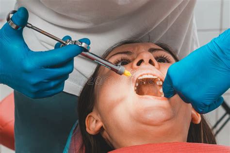 El Odontólogo Con La Ayuda De Una Jeringa Carpúrea Inyecta Anestesia En