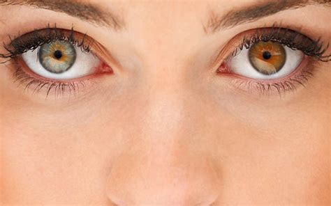 Ever Seen Celebrities With Two Different Eye Colors