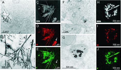 Tem Images Of Cells Exposed To Ag Nps Tem Images A B F And G Stem