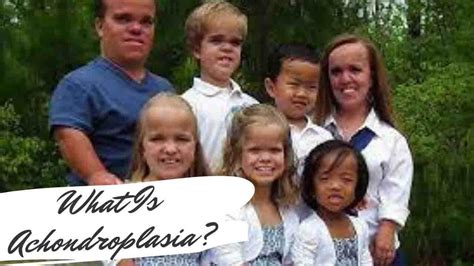 What Is Achondroplasia Causes Symptoms And Treatment Scientific