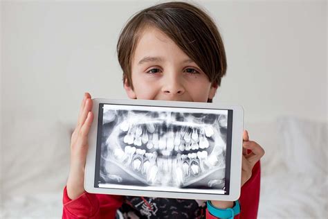 How Often Should My Child Have Dental X Rays Luna Pediatric Dentistry