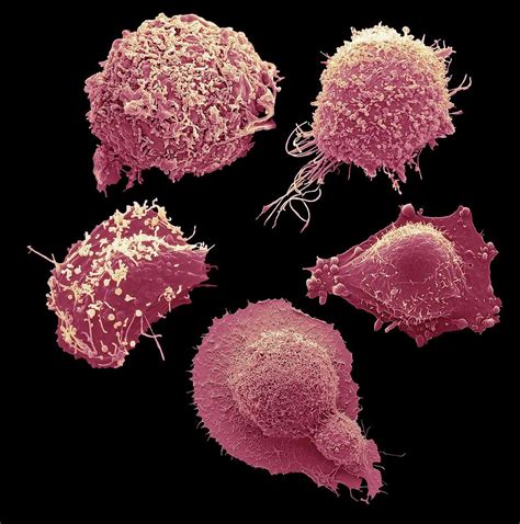 Cells From The Most Common Female Cancers Photograph By Steve