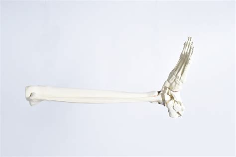 Lower Leg Right Fx W Soft Tissue Synbone