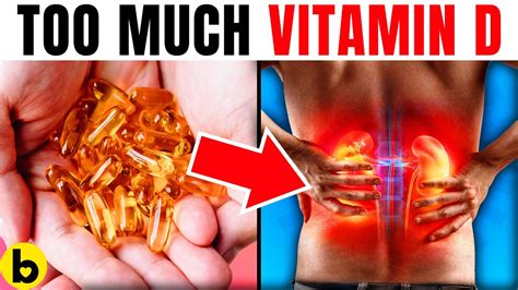 Too Much Vitamin D Is Dangerous Youtube