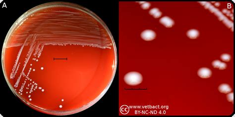 Enterococcus Faecalis