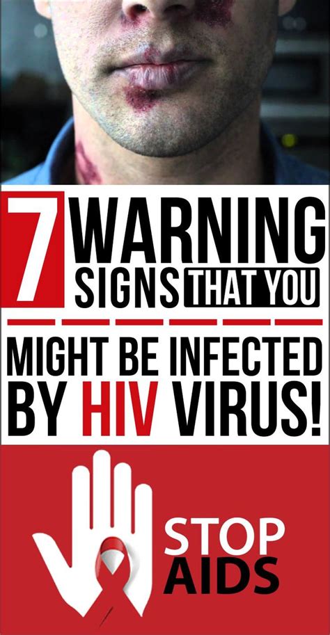 The 25 Best Hiv Symptoms In Men Ideas On Pinterest Symptoms Of Hiv