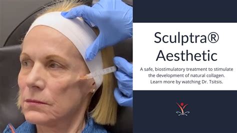 Why You Should Consider Sculptra Aesthetic Youtube