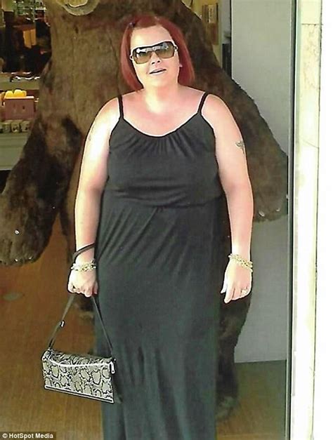 Hampshire Woman Forks Out £30000 On Weight Loss Surgery Daily Mail Online
