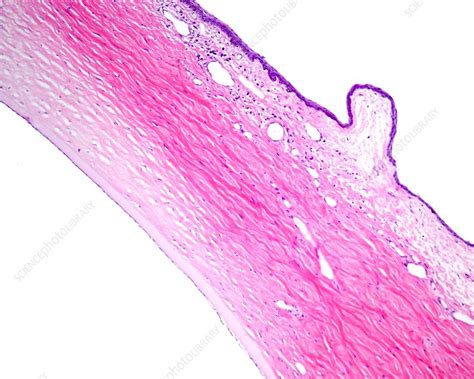Conjunctiva And Sclera Light Micrograph Stock Image C0521973