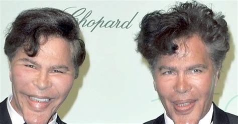 the bogdanoff twins igor and grichka born august 29 1949 plastic surgery gone horribly