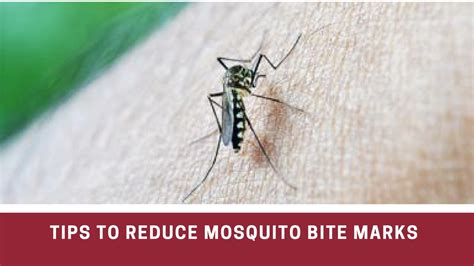 How To Remove Mosquito Bite Marks Naturally Youtube