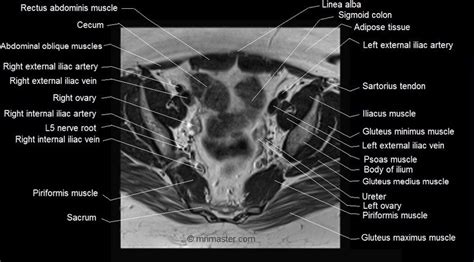 Mri Female Pelvis Anatomy Axial Image 12 Pelvis Anatomy Pelvis