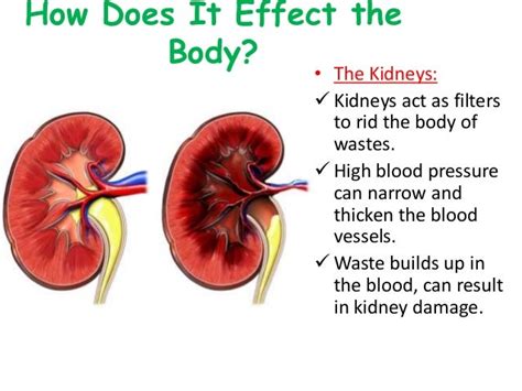 Kidney Effects On Blood Pressure Kidney Failure Disease