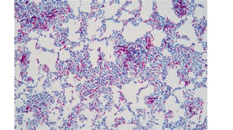 ACID FAST STAIN Laboratory Exercises In Microbiology