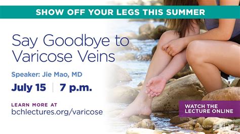 Bch Lecture Say Goodbye To Varicose Veins Youtube