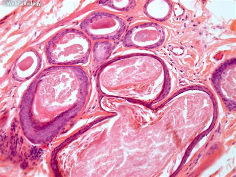 A Collection Of Surgical Pathology Images