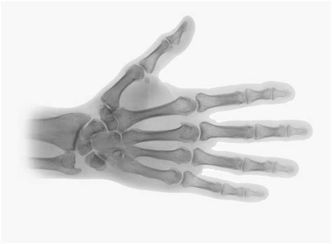 Crmla Hand X Ray Clipart Black And White