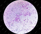 Premium Photo | Microscopic view of gram stain showing escherichia coli ...