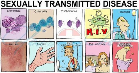 30 Best Sexually Transmitted Diseases Images On Pinterest Disease