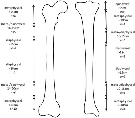 Femoral And Tibial Osteotomy Levels Download Scientific Diagram