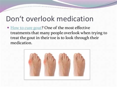 Most Effective Treatments For Gout In Foot