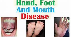 Hand, Foot and Mouth Disease | Viruses, Pathophysiology, Signs and Symptoms, Diagnosis, Treatment