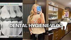 DENTAL HYGIENE VLOG | new house tour, & come to work w/ me!!! 🦷