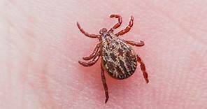 Experts in Indiana warn that ticks and Lyme disease a bigger problem due to COVID-19