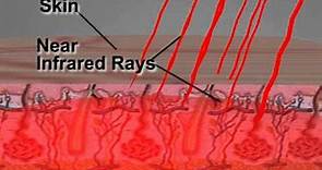 How Far Infrared Technology Works