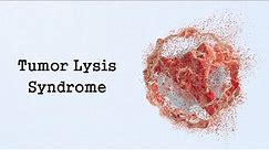 Tumor Lysis Syndrome (Oncologic Emergencies)