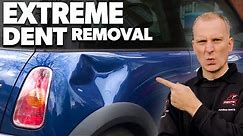 Extreme Dent Removal