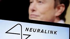 Elon Musk’s Neuralink says it has FDA approval for human trials: What to know