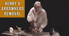 Henry V arrowhead removal | Medieval Surgery