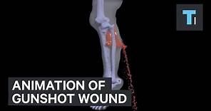 Animation of gunshot wound