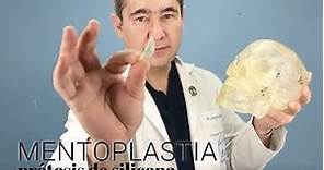 ¿Quién se puede aumentar el mentón? - Cirugía Plástica Mentoplastia - Dr. Jorge Espinosa