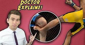 The Untold Side of the Most Famous Injury In UFC History - Anderson Silva's Broken Leg