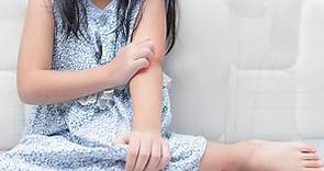 24 Common Skin Rashes in Children and Their Causes