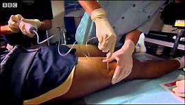 Colin Jackson's leg biopsy - The Making of Me - BBC