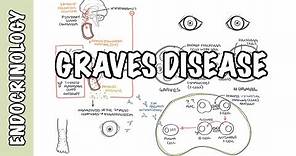 Graves Disease - Overview (causes, pathophysiology, investigations and treatment)