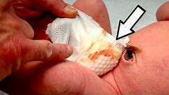 HELP! THERE'S BLOOD IN MY BABIES DIAPER... | Dr. Paul